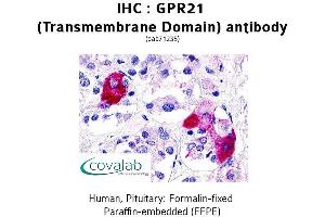 Image no. 2 for anti-G Protein-Coupled Receptor 21 (GPR21) antibody (ABIN1735029) (GPR21 anticorps)