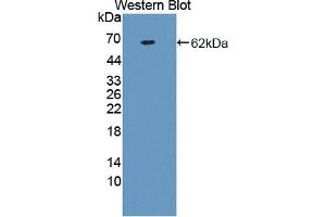 WB of Protein Standard: different control antibodies against Highly purified E. (Prothrombin Fragment 1+2 Kit ELISA)