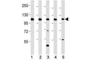 Western blot testing of Mertk antibody at 1:2000 dilution. (MERTK anticorps  (C-Term))