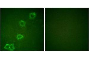 Immunofluorescence analysis of HuvEc cells, using BACE (Ab-498) Antibody. (BACE1 anticorps  (AA 452-501))