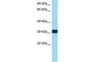 Image no. 1 for anti-Ribosomal Protein S3 (RPS3) (C-Term) antibody (ABIN6748416) (RPS3 anticorps  (C-Term))