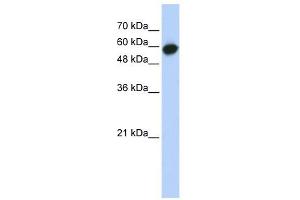 LRRC6 antibody used at 1 ug/ml to detect target protein.