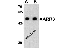 Western Blotting (WB) image for anti-Arrestin 3, Retinal (X-Arrestin) (ARR3) (C-Term) antibody (ABIN2457884) (ARR3 anticorps  (C-Term))