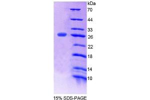 SDS-PAGE (SDS) image for Protein-O-Mannosyltransferase 1 (POMT1) (AA 318-513) protein (His tag) (ABIN4989503)