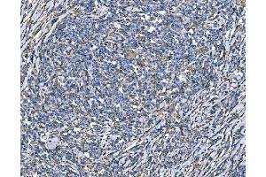 IHC analysis of SOD2 using anti-SOD2 antibody (ABIN7602799).