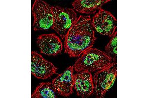 Fluorescent confocal image of U251 cell stained with KLF5 Antibody . (KLF5 anticorps  (C-Term))