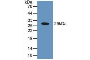Detection of Recombinant DPP4, Human using Polyclonal Antibody to Cluster Of Differentiation 26 (CD26) (DPP4 anticorps  (AA 484-728))