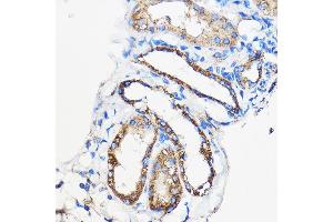 Immunohistochemistry of paraffin-embedded Mouse kidney using /// Rabbit pAb (ABIN7265627) at dilution of 1:50 (40x lens). (ANT1+ANT2+ANT3+ANT4 (C-Term) anticorps)