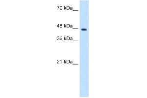 WB Suggested Anti-ZNF213 Antibody Titration:  1. (ZNF213 anticorps  (N-Term))