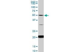 NADK monoclonal antibody (M01), clone 5F4. (NADK anticorps  (AA 1-446))