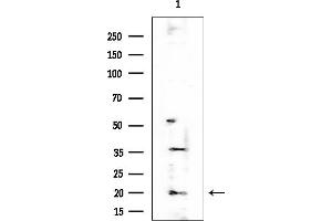 anti-Cold Inducible RNA Binding Protein (CIRBP) (C-Term) antibody