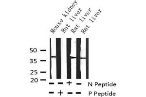 Western blot analysis of Phospho-CrkII (Tyr221) expression in various lysates