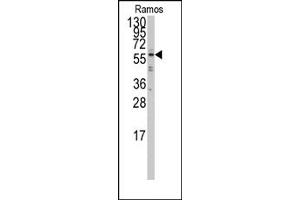 Image no. 1 for anti-Interferon Regulatory Factor 5 (IRF5) (N-Term) antibody (ABIN357996) (IRF5 anticorps  (N-Term))