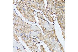 Immunohistochemistry of paraffin-embedded mouse heart using HAL antibody (ABIN6130467, ABIN6141593, ABIN6141594 and ABIN6216851) at dilution of 1:100 (40x lens).