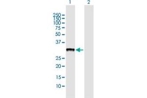 Western Blot analysis of CBR3 expression in transfected 293T cell line by CBR3 MaxPab polyclonal antibody.
