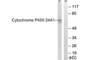 Western blot analysis of extracts from JurKat cells, using Cytochrome P450 24A1 Antibody. (CYP24A1 anticorps  (AA 411-460))