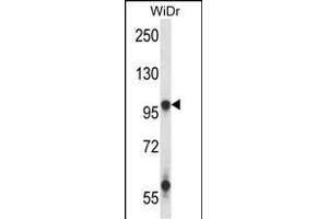 GRIA3 Antibody (N-term) (ABIN657962 and ABIN2846908) western blot analysis in WiDr cell line lysates (35 μg/lane). (Glutamate Receptor 3 anticorps  (N-Term))
