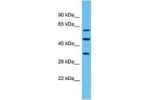 Western Blotting (WB) image for anti-Olfactory Receptor, Family 4, Subfamily F, Member 6 (OR4F6) (C-Term) antibody (ABIN2791737) (OR4F6 anticorps  (C-Term))