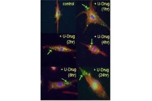 Mouse leukaemic monocyte macrophage cells treated with drug U18666A, causing cholesterol and lipid storage in cells, blocking fusion between late endosomes and lysosomes.