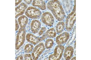 Immunohistochemistry of paraffin-embedded mouse kidney using C9orf72 Rabbit pAb (ABIN7266391) at dilution of 1:100 (40x lens).