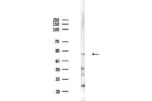 anti-La Ribonucleoprotein Domain Family, Member 6 (LARP6) antibody