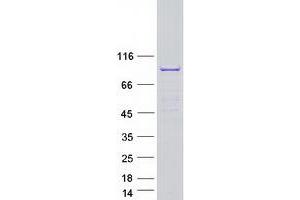 Validation with Western Blot