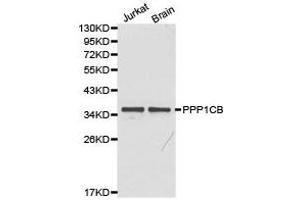 Western Blotting (WB) image for anti-Protein Phosphatase 1, Catalytic Subunit, beta Isoform (PPP1CB) antibody (ABIN1874218)
