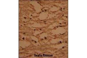 anti-HIV-1 Tat Specific Factor 1 (HTATSF1) (AA 1-30), (N-Term) antibody