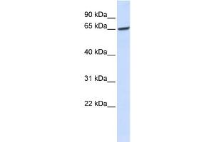 WB Suggested Anti-GPR177 Antibody Titration:  0. (GPR177/WLS anticorps  (Middle Region))