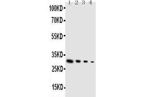 Anti-GDNF antibody, Western blotting Lane 1: Recombinant Human GDNF Protein 10ng Lane 2: Recombinant Human GDNF Protein 5ng Lane 3: Recombinant Human GDNF Protein 2.