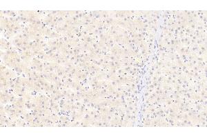 Detection of APOC3 in Human Liver Tissue using Polyclonal Antibody to Apolipoprotein C3 (APOC3)