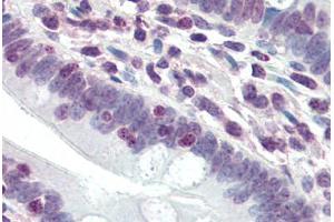 Human Small Intestine (formalin-fixed, paraffin-embedded) stained with DDX3X antibody ABIN396914 at 20 ug/ml followed by biotinylated goat anti-rabbit IgG secondary antibody ABIN481713, alkaline phosphatase-streptavidin and chromogen.
