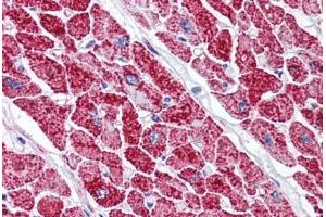 Human Heart (formalin-fixed, paraffin-embedded) stained with VDAC2 antibody ABIN337065 at 2. (VDAC2 anticorps  (AA 298-309))