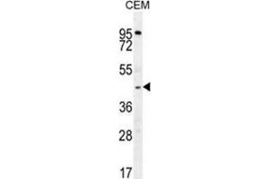 ZMYND10 Antibody (Center) western blot analysis in CEM cell line lysates (35 µg/lane). (ZMYND10 anticorps  (Middle Region))