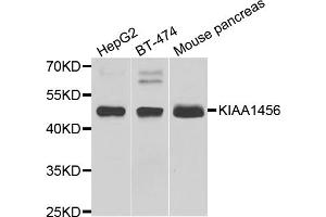 Western blot analysis of extracts of various cell lines, using KIAA1456 antibody (ABIN5974326) at 1/1000 dilution. (KIAA1456 anticorps)