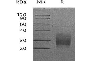 Western Blotting (WB) image for Tumor Necrosis Factor Receptor Superfamily, Member 10b (TNFRSF10B) protein (His tag,AVI tag) (ABIN7320862)