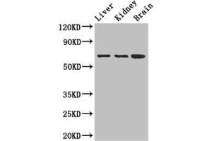 Western Blot Positive WB detected in: Mouse liver tissue, Mouse kidney tissue, Mouse brain tissue All lanes: AK5 antibody at 2. (Adenylate Kinase 5 anticorps  (AA 61-215))