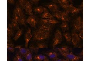 Immunofluorescence analysis of U-2 OS cells using IFITM3 Polyclonal Antibody at dilution of 1:100. (IFITM3 anticorps)