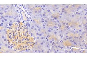 Detection of TF in Mouse Pancreas Tissue using Polyclonal Antibody to Tissue Factor (TF) (Tissue factor anticorps  (AA 30-251))