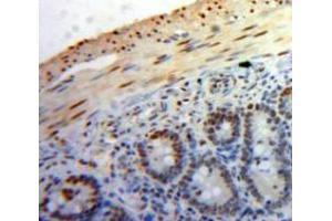 Used in DAB staining on fromalin fixed paraffin-embedded Bowels tissue (PPID anticorps  (AA 9-189))