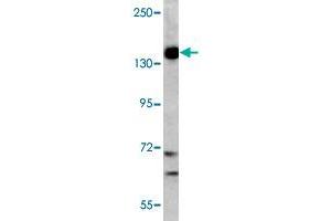 Western blot analysis of K-562 cell lysate (35 ug/lane) with PIK3CG polyclonal antibody . (PIK3 gamma anticorps  (C-Term))