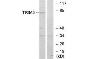 Western blot analysis of extracts from COLO cells, using TRIM3 Antibody. (TRIM3 anticorps  (AA 1-50))