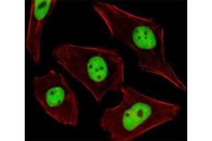 Fluorescent image of U251 cells stained with SUMO2/3 antibody. (SUMO2/3 anticorps  (AA 49-81))