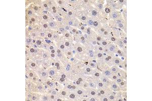 Immunohistochemistry of paraffin-embedded mouse liver using HNRNPD Antibody.