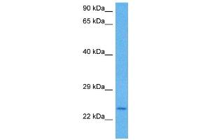 Host:  Rat  Target Name:  KLF9  Sample Tissue:  Rat Liver  Antibody Dilution:  1ug/ml