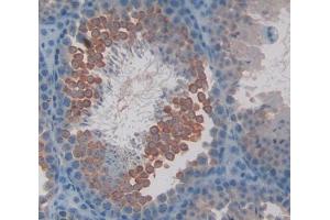 Used in DAB staining on fromalin fixed paraffin- embedded Kidney tissue (CAMLG anticorps  (AA 1-187))