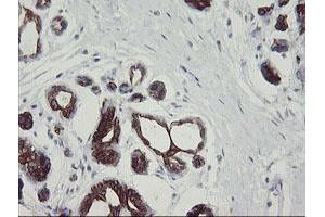 Image no. 10 for anti-Src-like-adaptor 2 (SLA2) antibody (ABIN1500949) (SLAP2 anticorps)