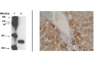 Immunohistochemistry (IHC) image for anti-Cytochrome P450, Family 2, Subfamily A, Polypeptide 6 (CYP2A6) (C-Term), (pSer472) antibody (ABIN264498) (CYP2A6 anticorps  (C-Term, pSer472))