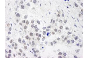 Immunohistochemistry (IHC) image for anti-Replication Protein A1, 70kDa (RPA1) (AA 350-400) antibody (ABIN7448781)