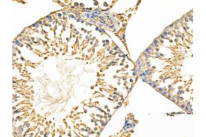 ABIN6258818 and ABIN6274459 at 1/100 staining Rat testis tissue by IHC-P. (KAT2A anticorps  (C-Term))